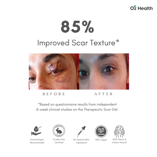 Dermae Scar Gel Singapore