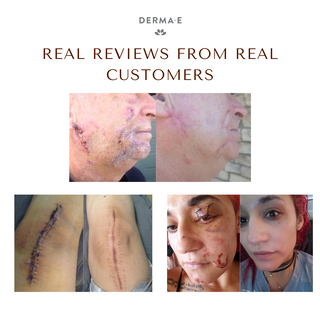 Derma E | Scar Gel 56g Reviews