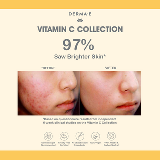 Derma E Vitamin C Gentle Daily Cleansing Paste, 113g