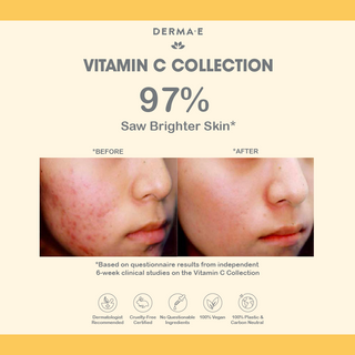 Derma E Vitamin C Renewing Moisturizer 60ml