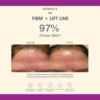 Derma E Stem Cell Lifting Eye Treatment 14g