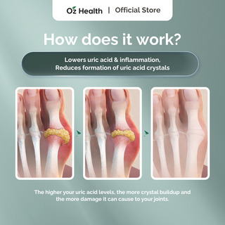 Oz Health Uricare 60 veg caps – Gout Support | Helps Reduce Uric Acid & Joint Inflammation