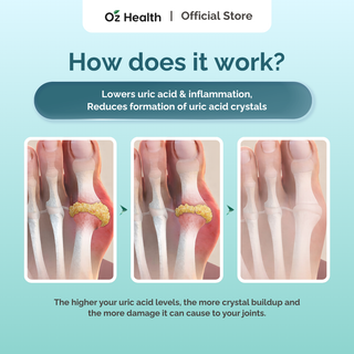 Oz Health Uricare 60 veg caps – Gout Support | Helps Reduce Uric Acid & Joint Inflammation
